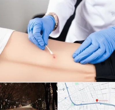 متخصص زخم بستر در ابوریحان تبریز 