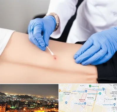 متخصص زخم بستر در مارلیک کرج 