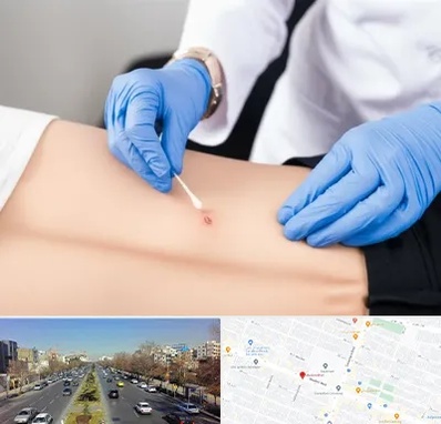 متخصص زخم بستر در بلوار معلم مشهد 