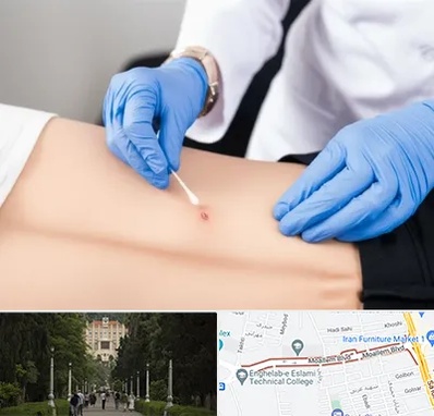 متخصص زخم بستر در بلوار معلم رشت 