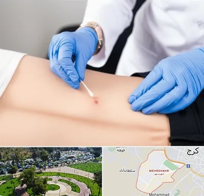 متخصص زخم بستر در مهرشهر کرج 