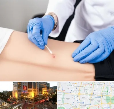 متخصص زخم بستر در جنت آباد تهران 