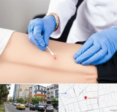 متخصص زخم بستر در هفده شهریور تبریز 