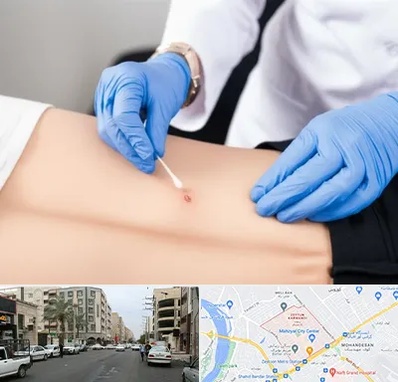 متخصص زخم بستر در زیتون کارمندی اهواز 