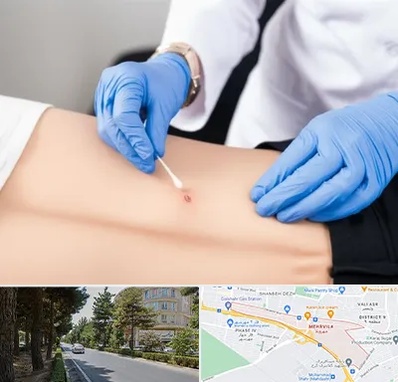 متخصص زخم بستر در مهرویلا کرج 