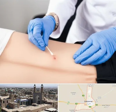متخصص زخم بستر در سبزوار