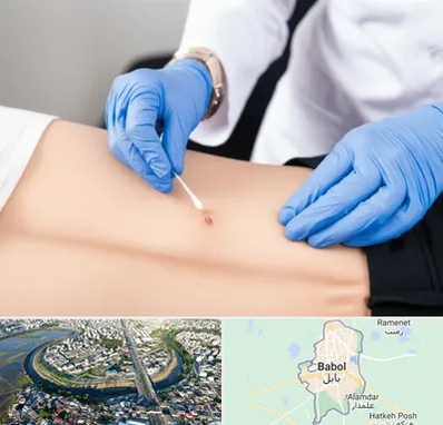 متخصص زخم بستر در بابل