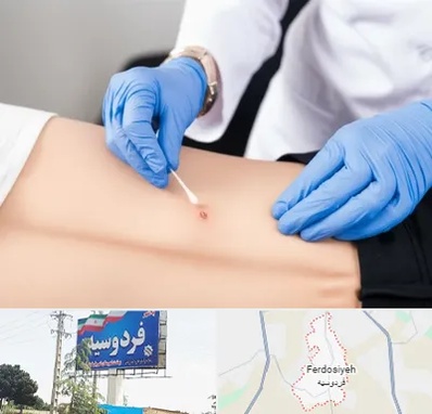 متخصص زخم بستر در فردوسیه شهریار