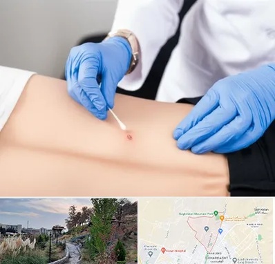 متخصص زخم بستر در باغستان کرج 