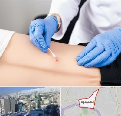 متخصص زخم بستر در محمودیه