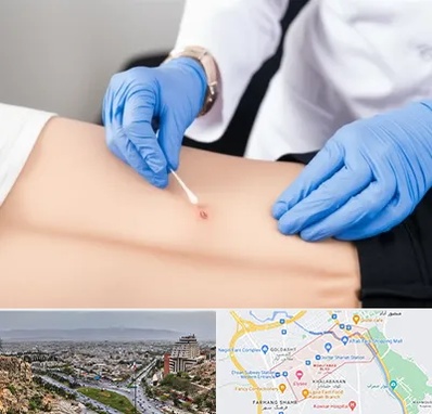 متخصص زخم بستر در معالی آباد شیراز 