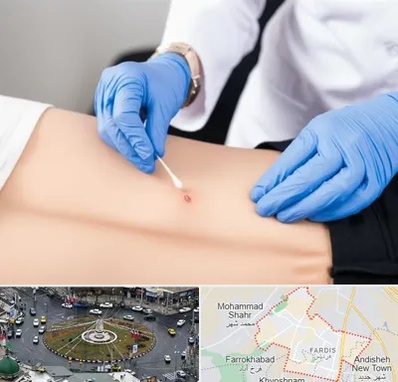 متخصص زخم بستر در فردیس کرج 