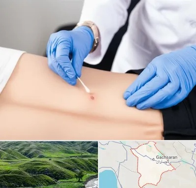 متخصص زخم بستر در گچساران