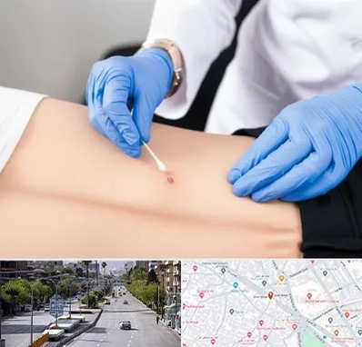 متخصص زخم بستر در خیابان زند شیراز 