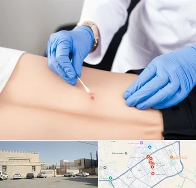 متخصص زخم بستر در نواب اسلامشهر 