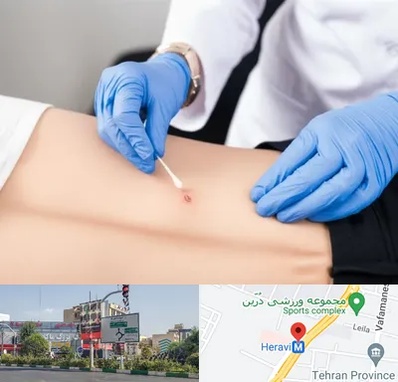 متخصص زخم بستر در هروی 