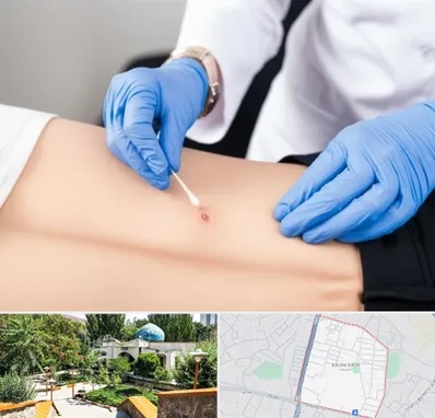 متخصص زخم بستر در باغمیشه تبریز 