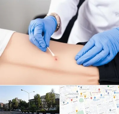 متخصص زخم بستر در میدان کاج 