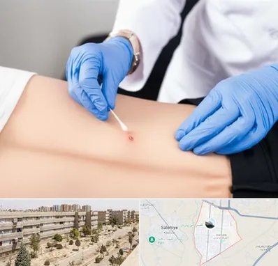 متخصص زخم بستر در واوان اسلامشهر 