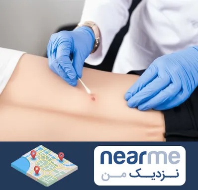 متخصص زخم بستر در نزدیک من