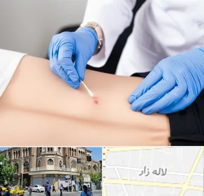 متخصص زخم بستر در لاله زار