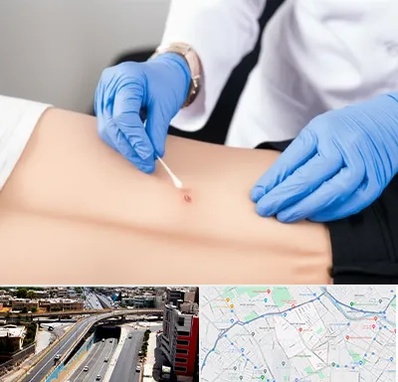 متخصص زخم بستر در ستارخان شیراز 