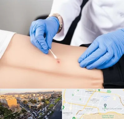 متخصص زخم بستر در تهرانپارس 