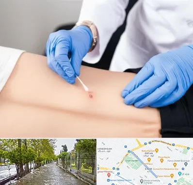 متخصص زخم بستر در خیابان ارم شیراز 