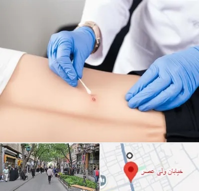 متخصص زخم بستر در ولیعصر شهریار