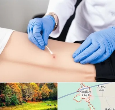 متخصص زخم بستر در کردکوی