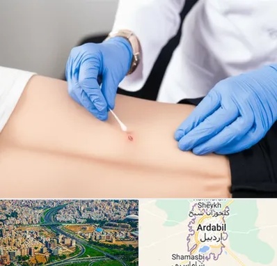 متخصص زخم بستر در اردبیل