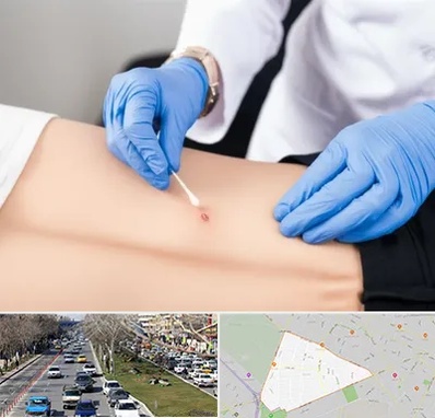 متخصص زخم بستر در احمدآباد مشهد 