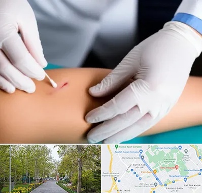 متخصص زخم عفونی در قدوسی غربی شیراز 