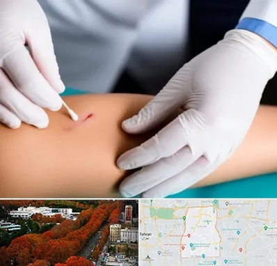 متخصص زخم عفونی در منطقه 6 تهران 