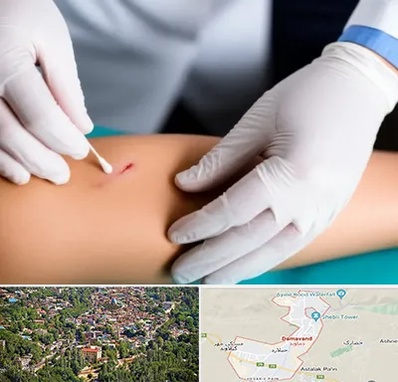 متخصص زخم عفونی در دماوند