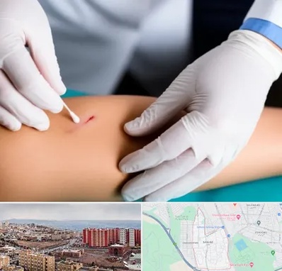 متخصص زخم عفونی در سهند تبریز 