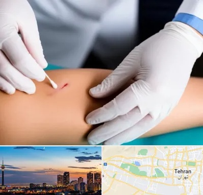 متخصص زخم عفونی در غرب تهران 