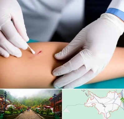 متخصص زخم عفونی در فومن