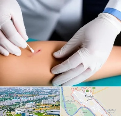 متخصص زخم عفونی در آبادان