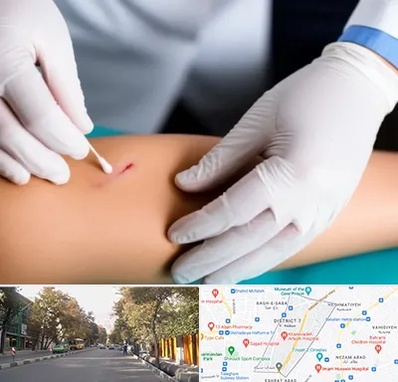 متخصص زخم عفونی در شریعتی 