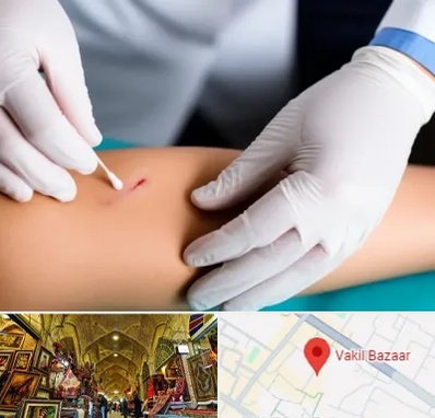 متخصص زخم عفونی در بازار وکیل شیراز