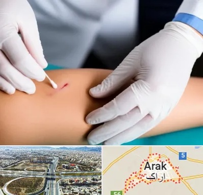 متخصص زخم عفونی در اراک
