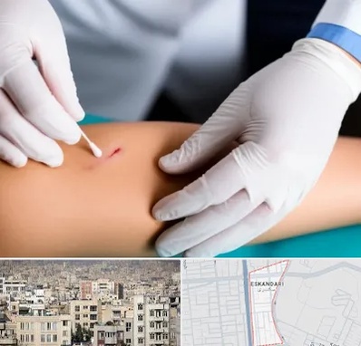 متخصص زخم عفونی در اسکندری