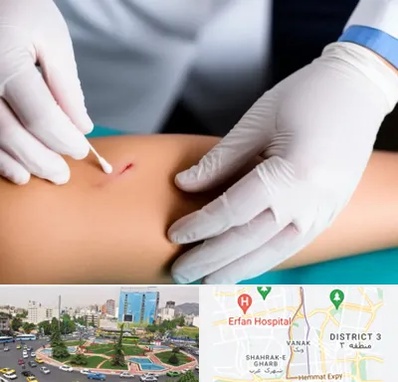 متخصص زخم عفونی در ونک 