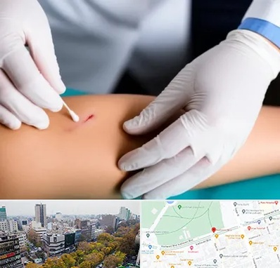 متخصص زخم عفونی در بلوار کشاورز 