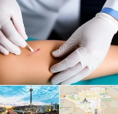 متخصص زخم عفونی در تهران