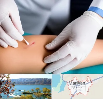 متخصص زخم عفونی در مریوان
