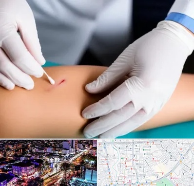 متخصص زخم عفونی در منظریه رشت 