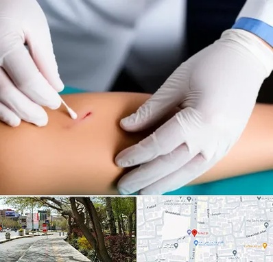 متخصص زخم عفونی در خیابان توحید اصفهان 