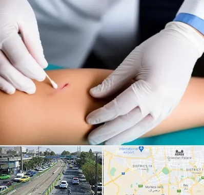 متخصص زخم عفونی در جنوب تهران 